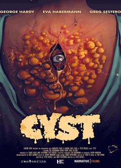 Cyst wiflix